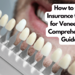 How to Get Insurance to Pay for Veneers